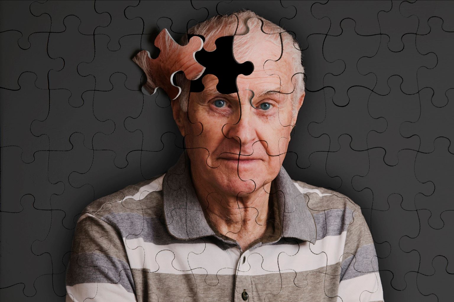 Những điều bạn cần biết về bệnh Alzheimer